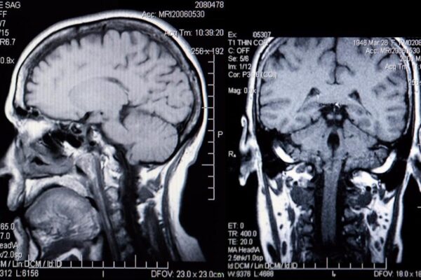 Режим активации сознания